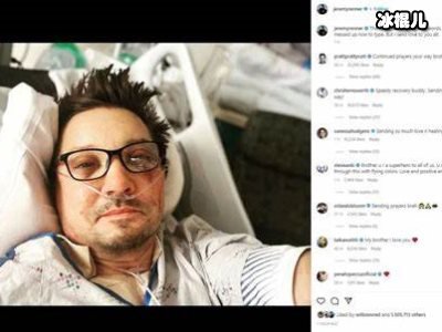 “鹰眼”晒术后自拍，面部大片淤血事故原因曝出