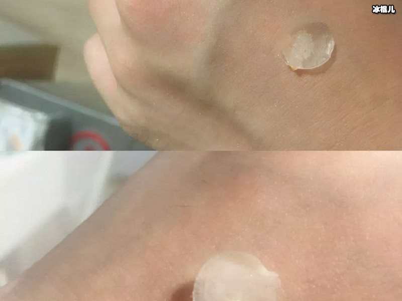 油痘肌女生该如何美白祛痘，这款产品一定要有！