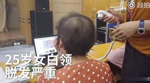 女白领发量仅剩三成是怎么回事 现代上班族如何防治掉发